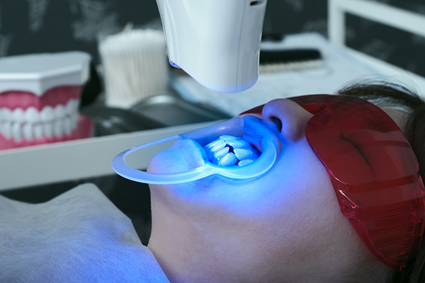 ホワイトニング